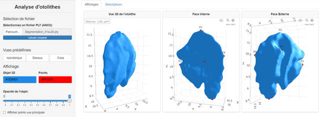 Otolith Landmark Prediction